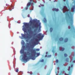 A photo of a typical glandular cells