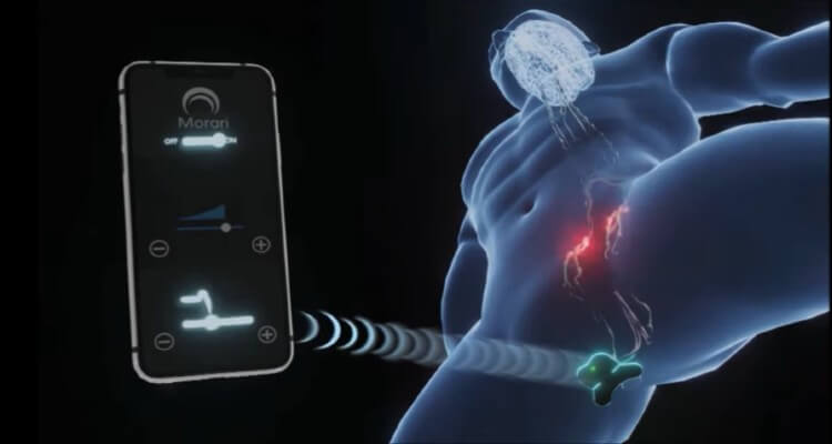 Screenshot from video clip demonstrating Morari wearable product for treating PE